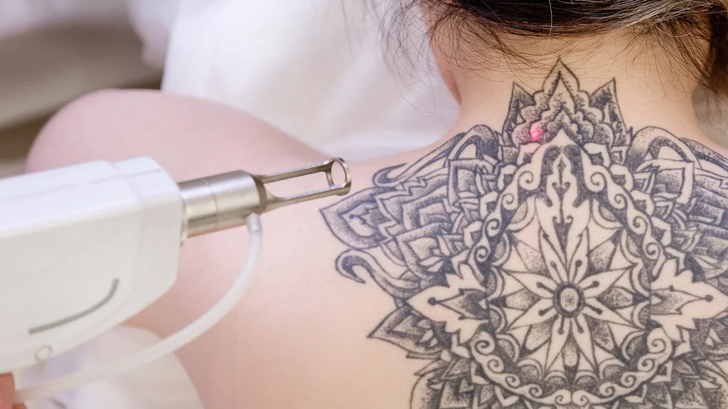 Comprendre la science de l'effacement des tatouages et ses enjeux