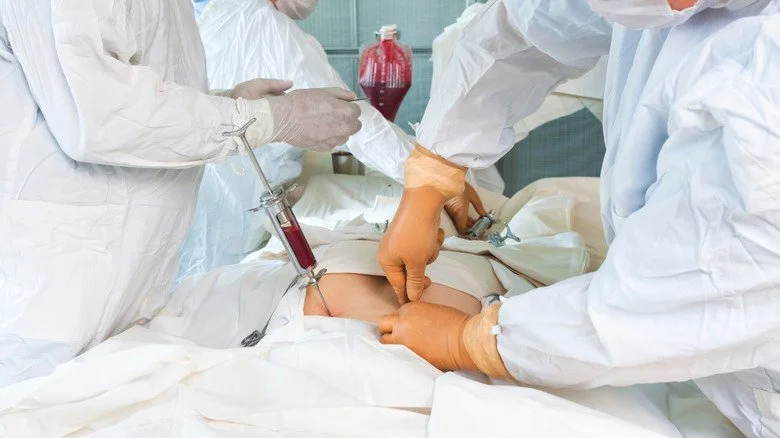 Transplantation de moelle osseuse