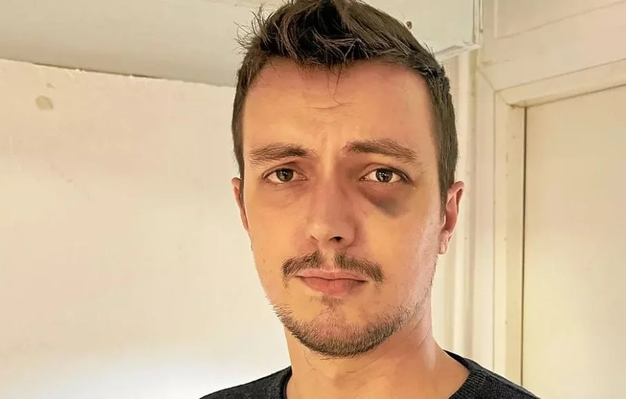 Agression d'un élu à Rennes : un salut nazi choquant