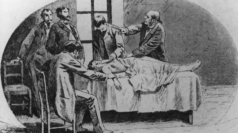 Chirurgie au 19ème siècle – Source : Hulton Archive/Getty Images