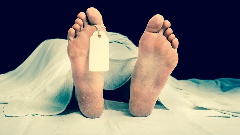 Cadavre médical – Source : andriano.cz/Shutterstock