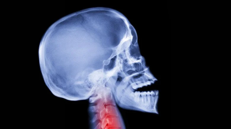 Radiographie du crâne de profil