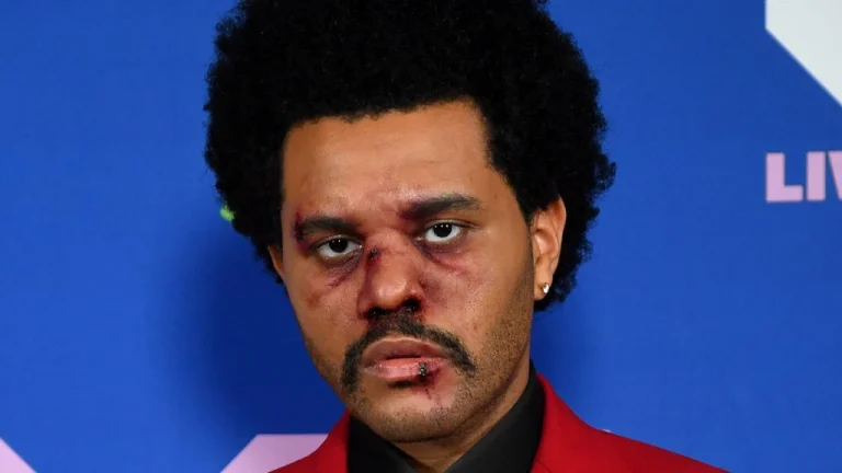 The Weeknd : Son Apparence Étonnante Dévoilée !
