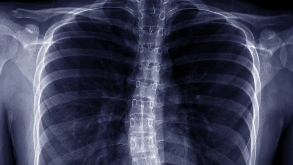 Radiographie de la colonne vertébrale
