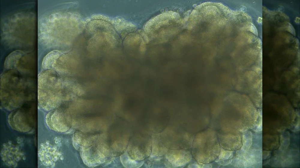 Organoïdes cérébraux humains, aussi appelés 'mini cerveaux', petites boules de cellules cérébrales allant de la taille d'un grain de pavot à un petit pois