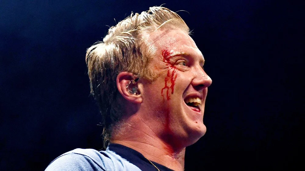 Josh Homme le visage ensanglanté