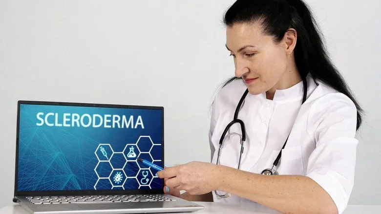 Médecin illustrant la sclérodermie