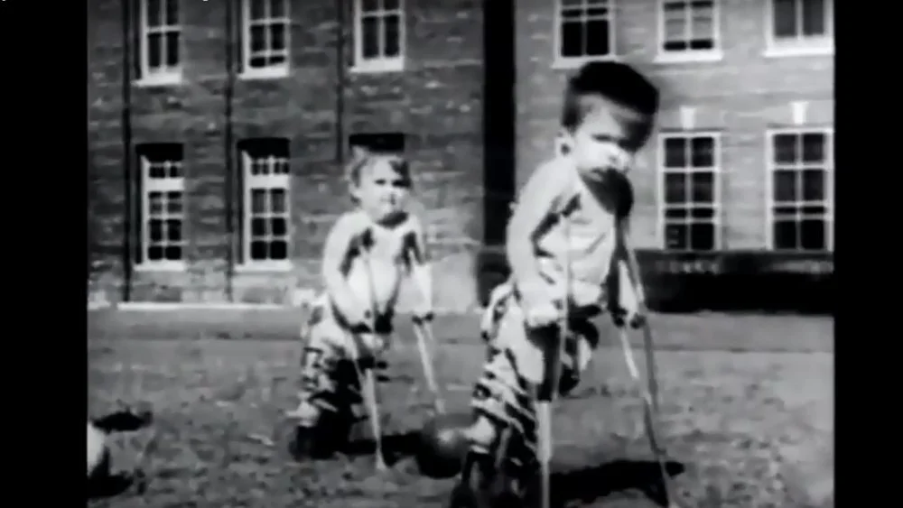 Enfants atteints de la polio