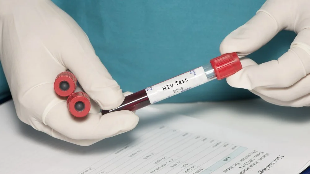 Test VIH