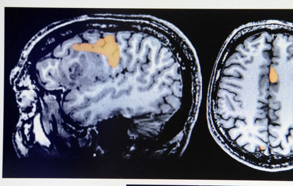 Justice italienne : Hôpital condamné pour erreur médicale grave