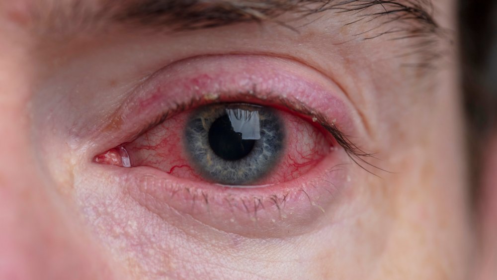 Homme privé de sommeil