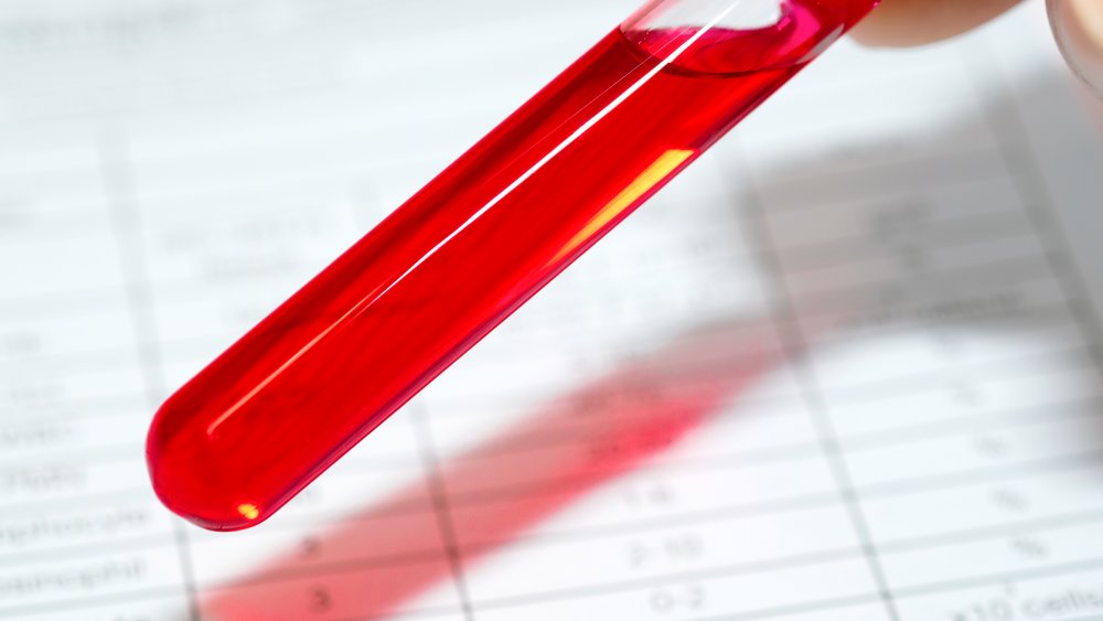 Échantillon de sang