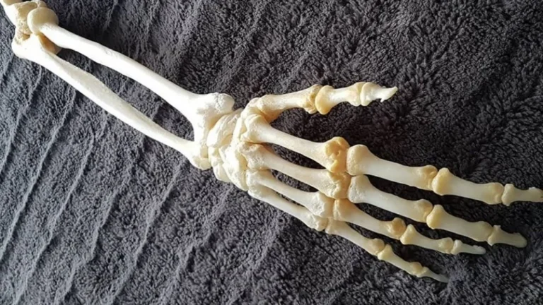 Un Canadien fait conserver son bras amputé par taxidermie