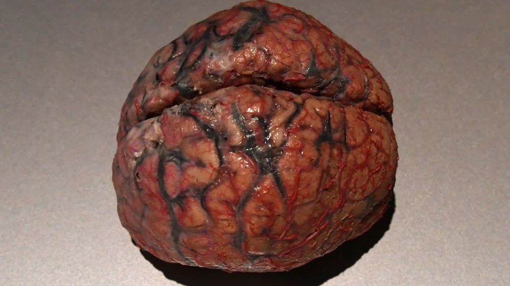 Comment un ver solitaire peut envahir votre cerveau