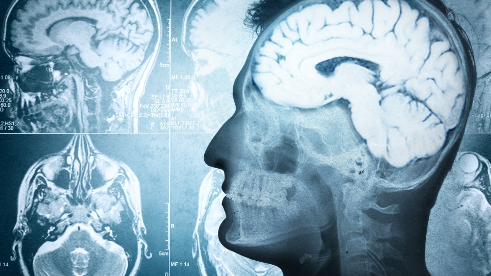 technologie du cerveau et télépathie